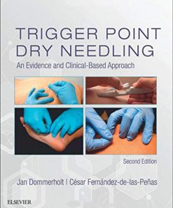 Trigger Point Dry Needling: An Evidence and Clinical-Based Approach - 2nd Edition